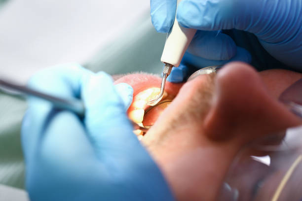Best Tooth Infection Emergency Dentist  in Monument Beach, MA